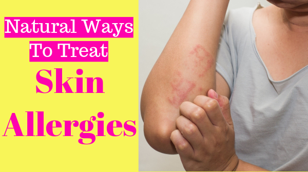 skin allergies home remedies