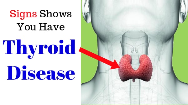 Symptoms of Underactive Thyroid